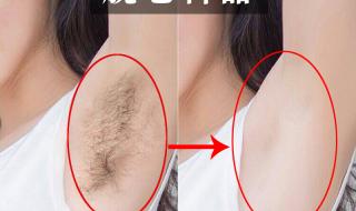 永久脱毛需要多少钱